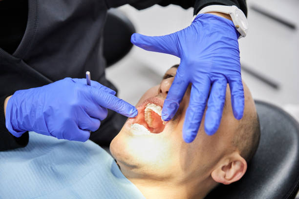 Best Chipped Tooth Repair Near Me  in Plymouth, WI